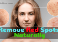 Remove Red Spots Naturally