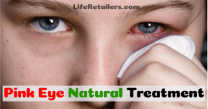 Read more about the article Natural Treatment of Conjunctivitis or Pink Eye with Home Remedies